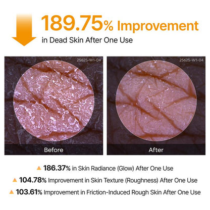 GlowFlux Peel Shot Keratin Care Kojic Acid Tumeric Spray